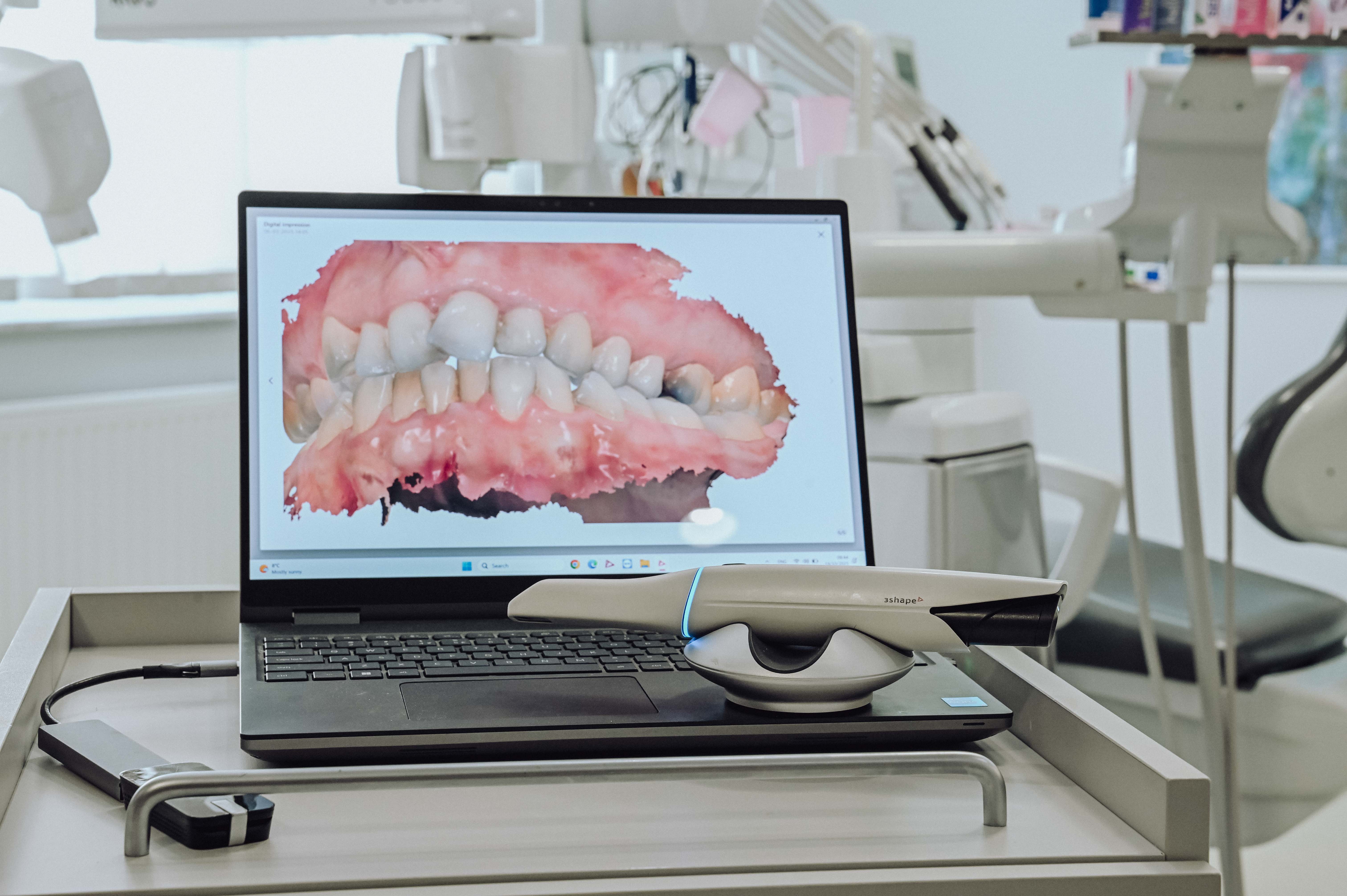 3Shape digitalni skener